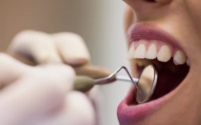 Dévitalisation dentaire : comment ça se passe ?