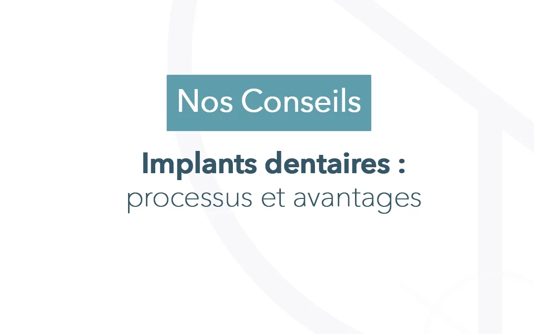 Implants dentaires : processus et avantages